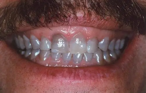 before dentistry at Flax Dental