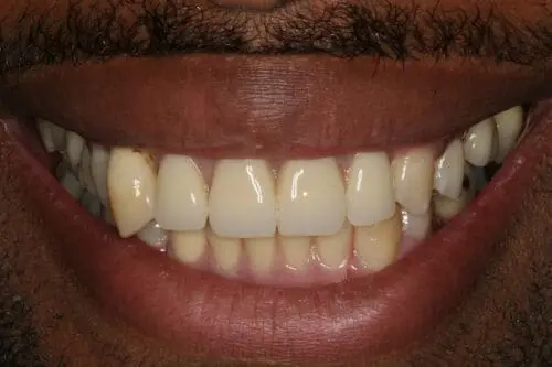 before dentistry at Flax Dental