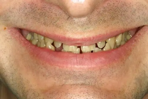before dentistry at Flax Dental