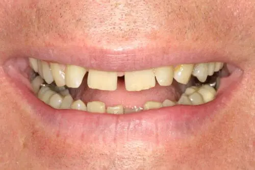 before dentistry at Flax Dental