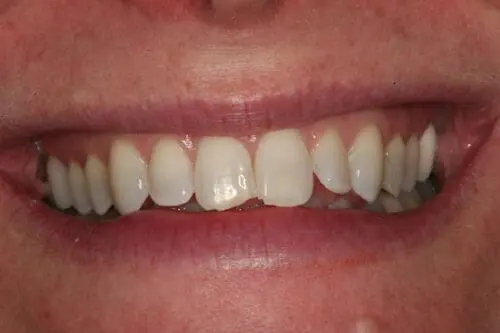 before dentistry at Flax Dental