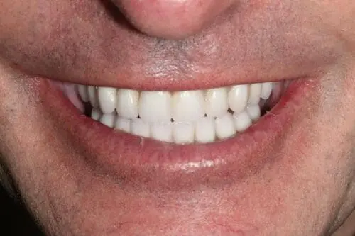 after dentistry at Flax Dental