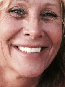 cosmetic dentistry results