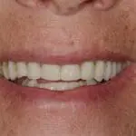 cosmetic dentistry results