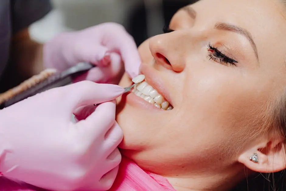 are veneers permanent