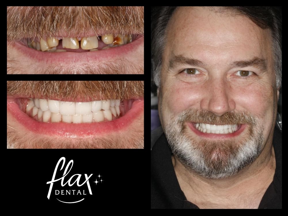 Cosmetic dentistry results in Sandy Springs GA