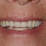 cosmetic dentistry results