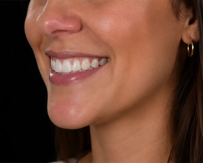 Close-up photo