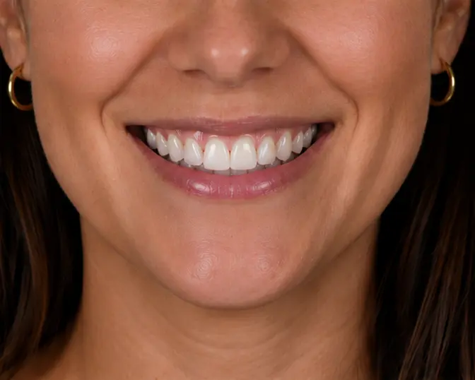 Close-up photo