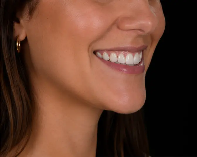 Close-up photo