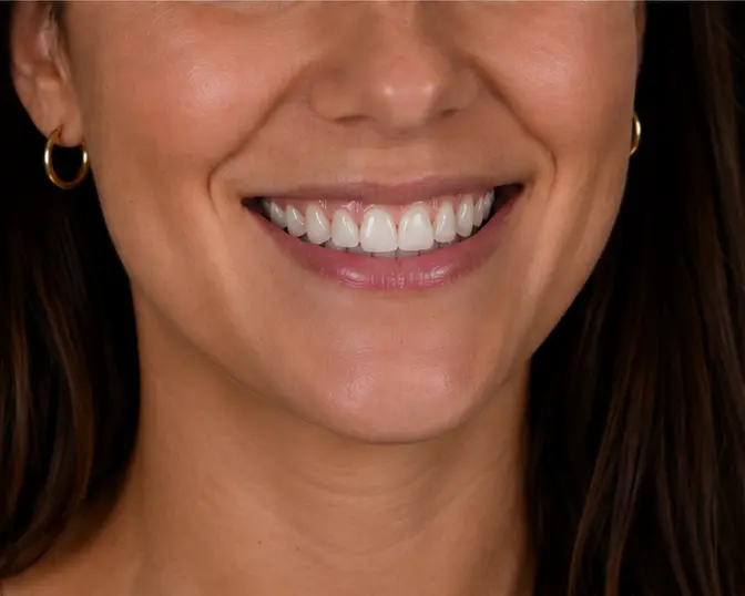 Close-up photo