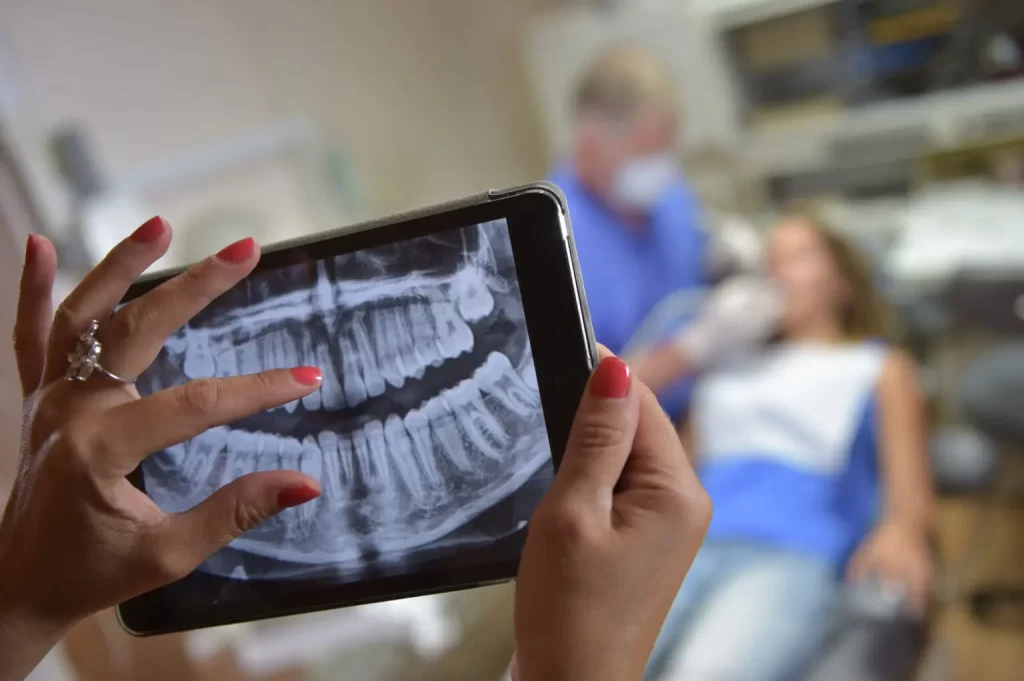 Tooth extraction in Atlanta and Sandy Springs, GA