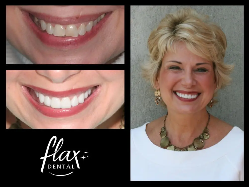 Smile Makeovers in Atlanta, GA