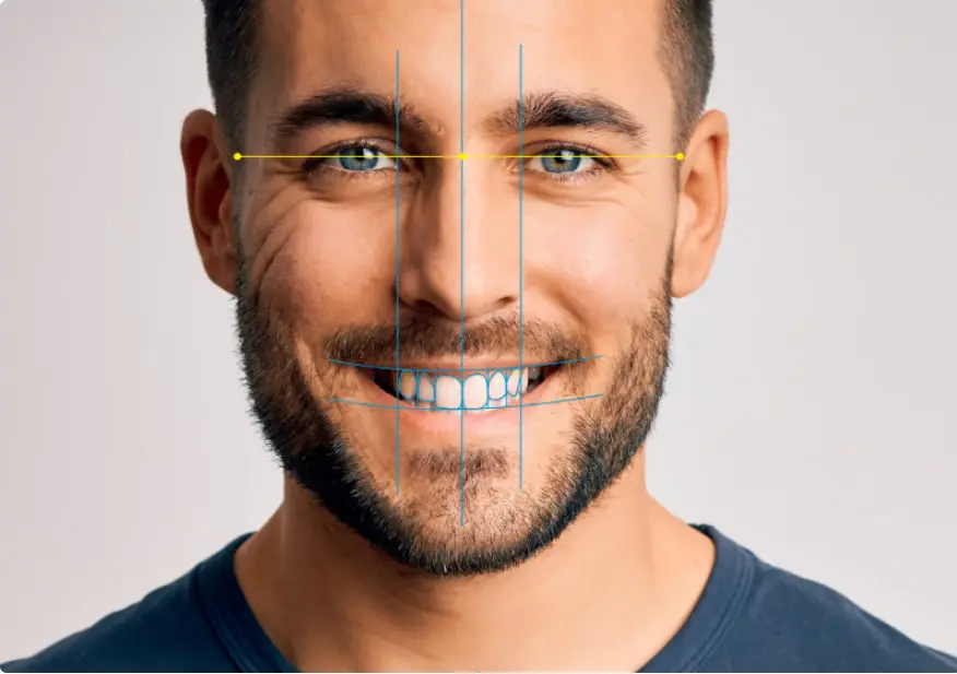 Smile Architect digital smile design in Sandy Springs, Atlanta