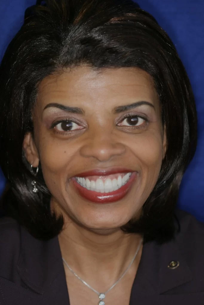 Patient portrait after orthodontics and veneers at Flax Dental, Atlanta