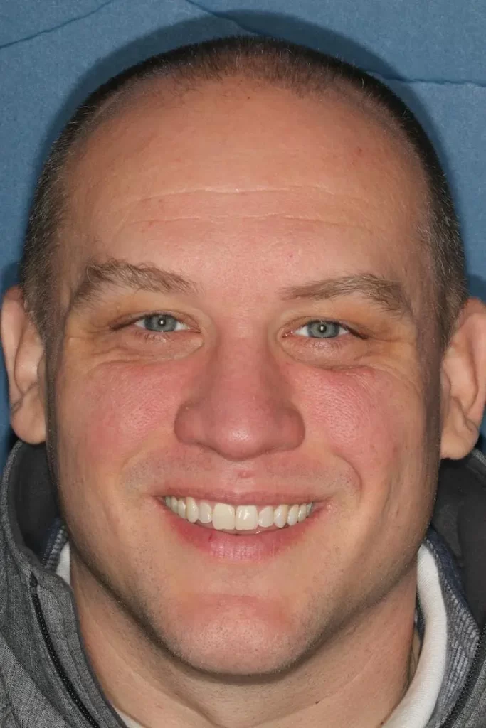 Patient portrait after preventative dentistry at Flax Dental, Atlanta
