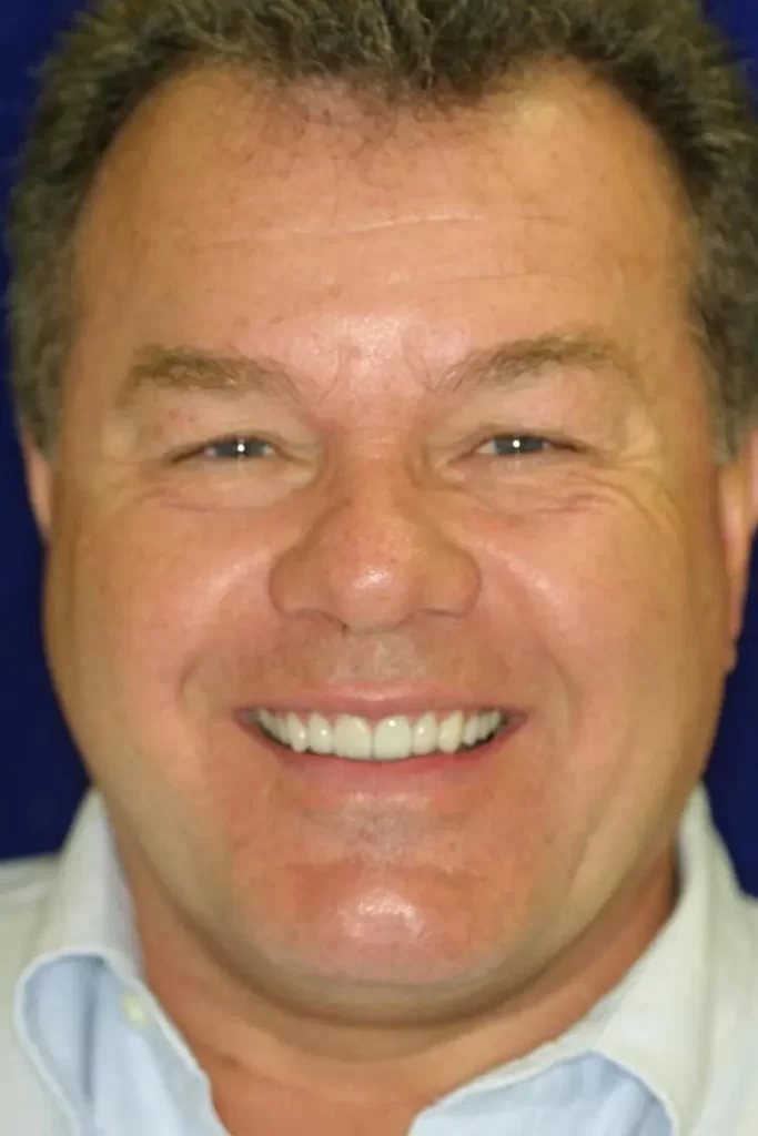 Patient portrait after veneers at Flax Dental, Atlanta