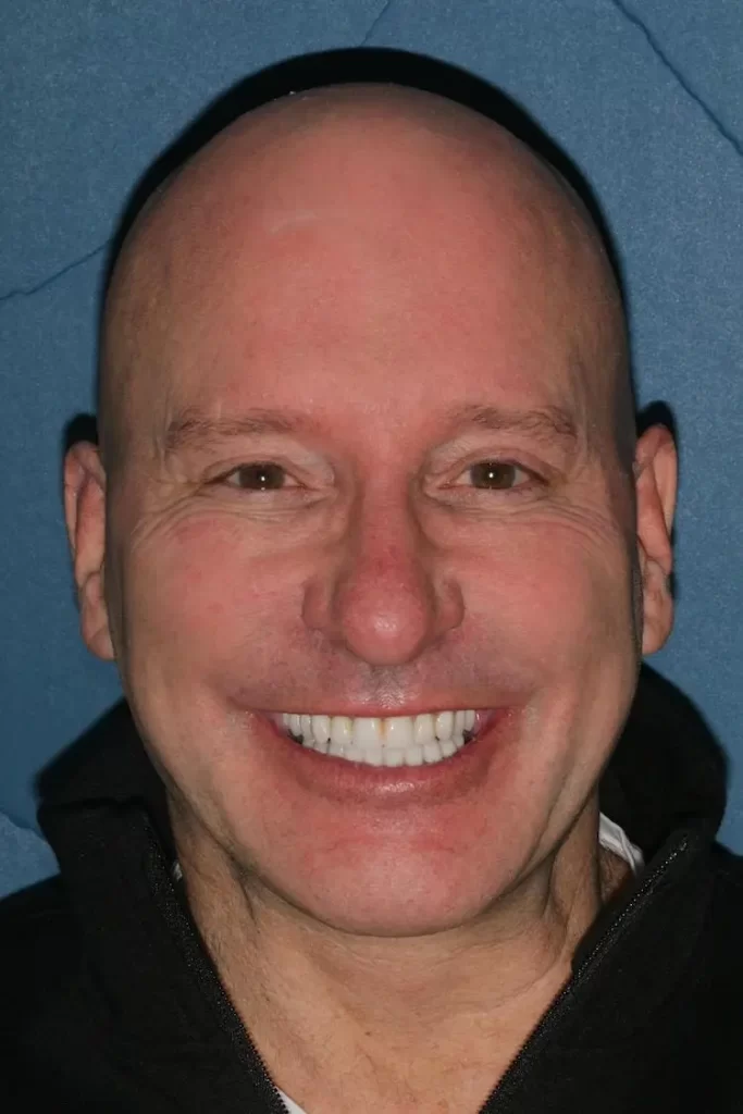 Patient portrait after dental implants at Flax Dental, Atlanta