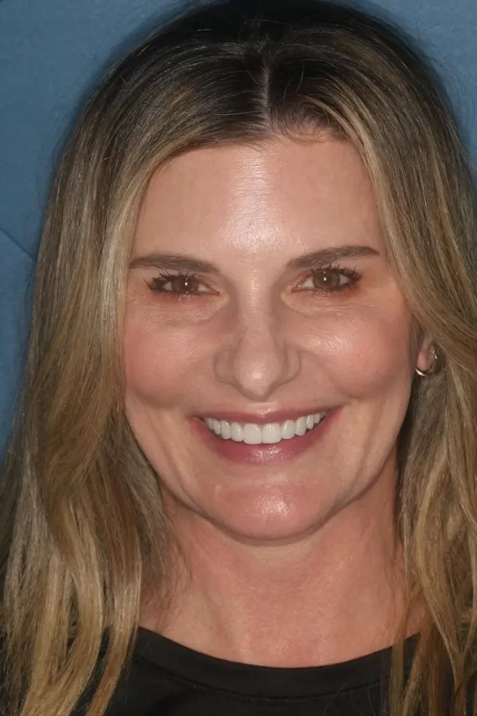 Patient portrait after smile makeover at Flax Dental, Atlanta