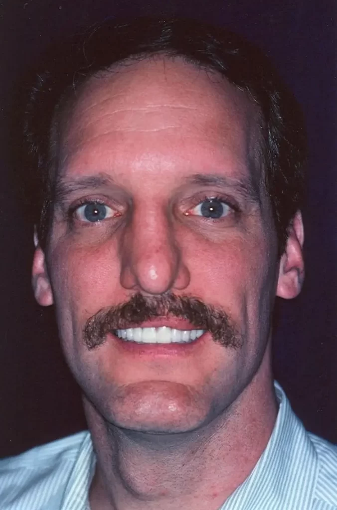 Patient portrait after smile makeover at Flax Dental, Atlanta