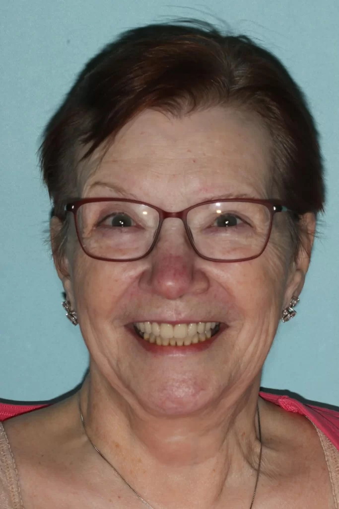 Patient portrait after smile makeover at Flax Dental, Atlanta