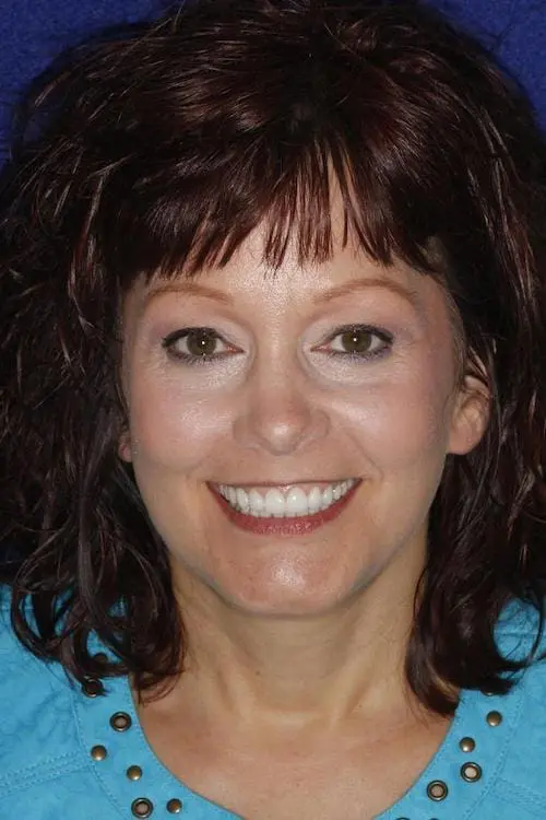 Patient portrait after cosmetic dentistry at Flax Dental, Atlanta